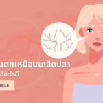 ผิวแห้งแตกเหมือนเกล็ดปลา เกิดจากอะไร